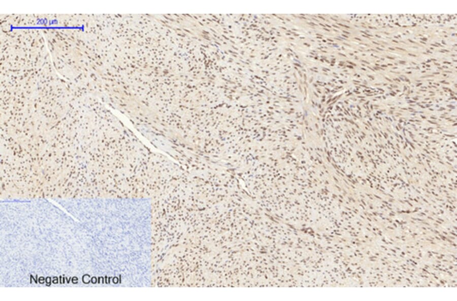 Immunohistochemistry - Anti-SAPK (phospho Tyr185) Antibody (A7129) - Antibodies.com