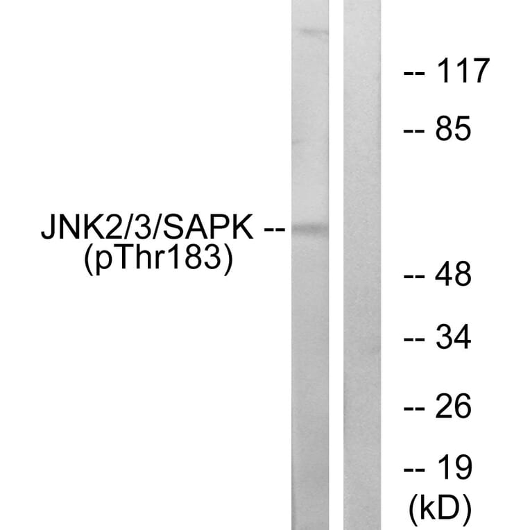 Western Blot - Anti-SAPK (phospho Thr183) Antibody (A7128) - Antibodies.com