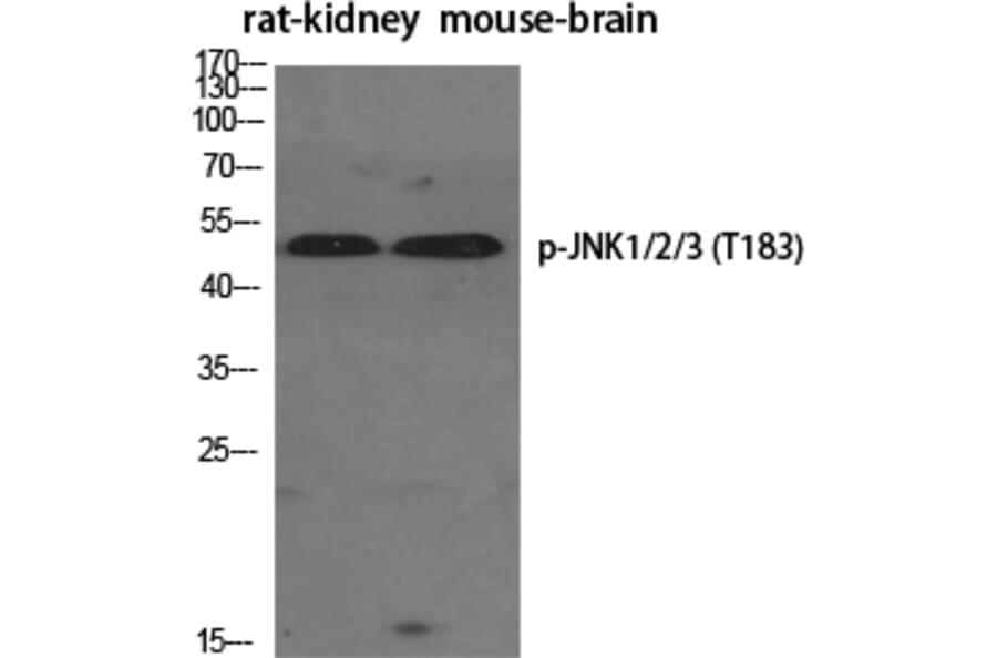 Western Blot - Anti-SAPK (phospho Thr183) Antibody (A7128) - Antibodies.com