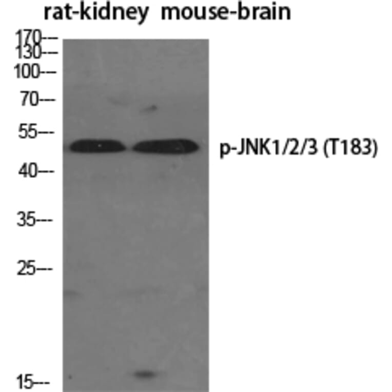 Western Blot - Anti-SAPK (phospho Thr183) Antibody (A7128) - Antibodies.com