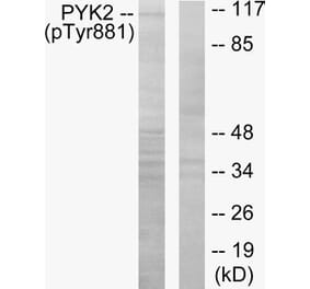 Western Blot - Anti-PYK2 (phospho Tyr881) Antibody (A0083) - Antibodies.com