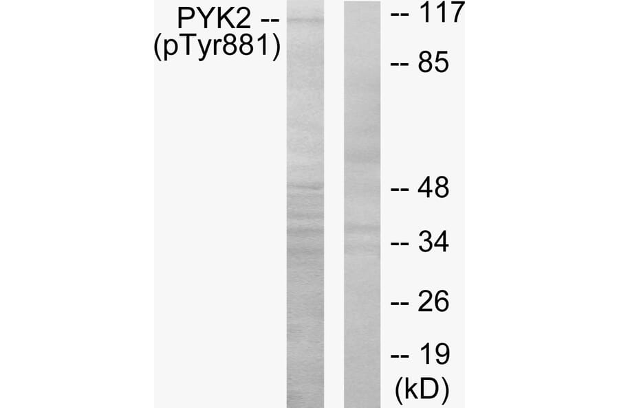 Western Blot - Anti-PYK2 (phospho Tyr881) Antibody (A0083) - Antibodies.com