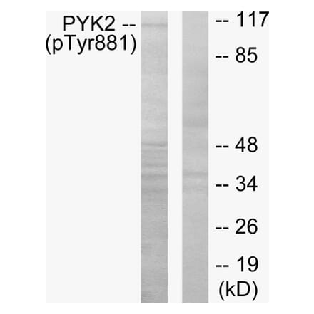 Western Blot - Anti-PYK2 (phospho Tyr881) Antibody (A0083) - Antibodies.com