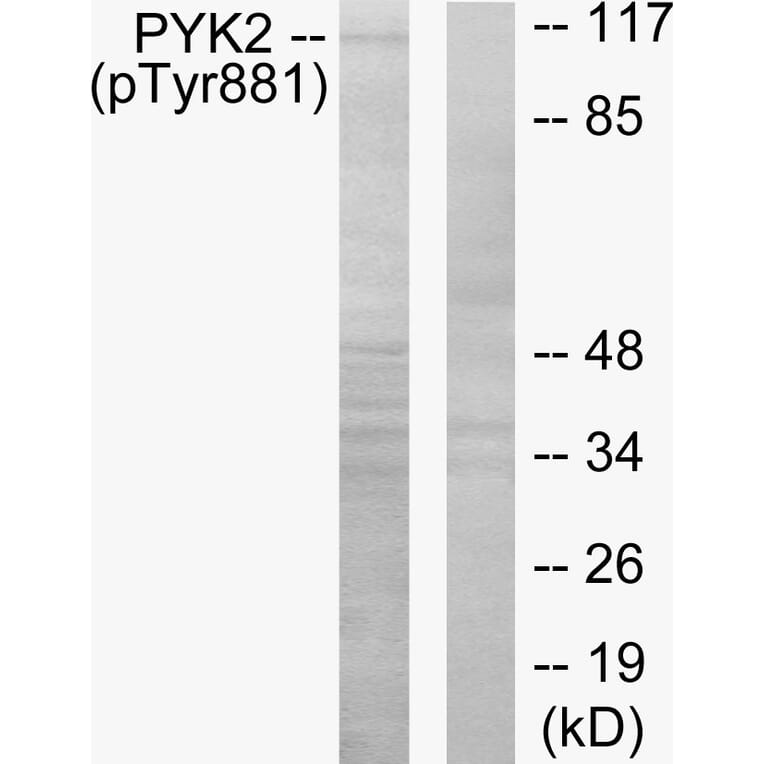 Western Blot - Anti-PYK2 (phospho Tyr881) Antibody (A0083) - Antibodies.com