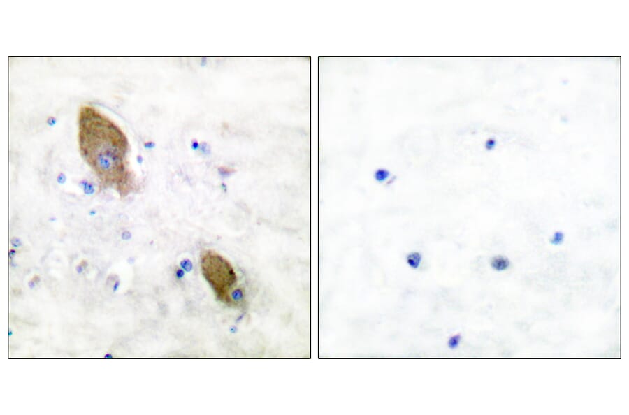 Immunohistochemistry - Anti-PYK2 (phospho Tyr881) Antibody (A0083) - Antibodies.com