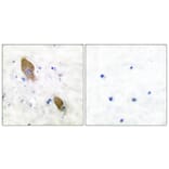 Immunohistochemistry - Anti-PYK2 (phospho Tyr881) Antibody (A0083) - Antibodies.com