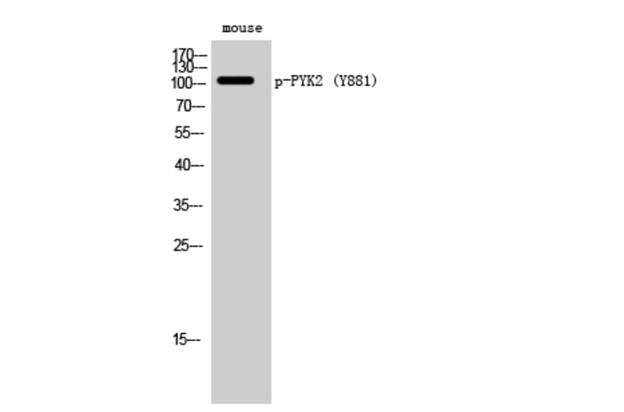 Western Blot - Anti-PYK2 (phospho Tyr881) Antibody (A0083) - Antibodies.com