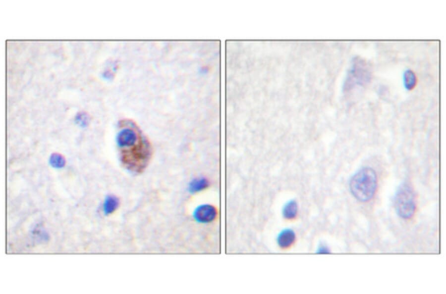 Immunohistochemistry - Anti-PYK2 (phospho Tyr881) Antibody (A0083) - Antibodies.com