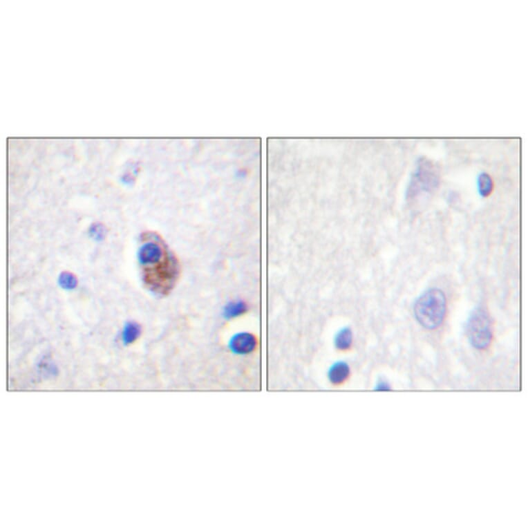 Immunohistochemistry - Anti-PYK2 (phospho Tyr881) Antibody (A0083) - Antibodies.com