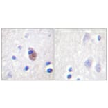 Immunohistochemistry - Anti-PYK2 (phospho Tyr881) Antibody (A0083) - Antibodies.com