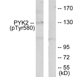 Western Blot - Anti-PYK2 (phospho Tyr580) Antibody (A0084) - Antibodies.com