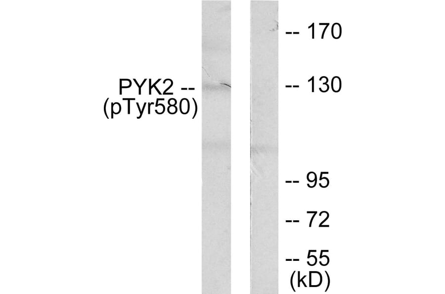 Western Blot - Anti-PYK2 (phospho Tyr580) Antibody (A0084) - Antibodies.com