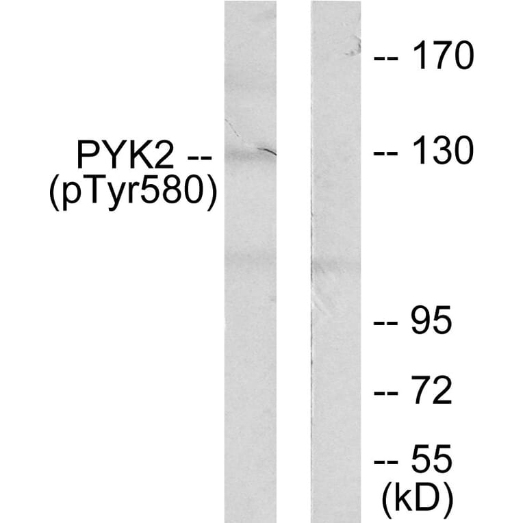 Western Blot - Anti-PYK2 (phospho Tyr580) Antibody (A0084) - Antibodies.com