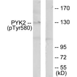 Western Blot - Anti-PYK2 (phospho Tyr580) Antibody (A0084) - Antibodies.com