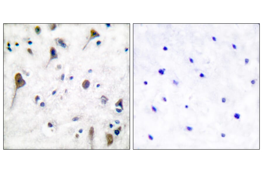 Immunohistochemistry - Anti-PYK2 (phospho Tyr580) Antibody (A0084) - Antibodies.com