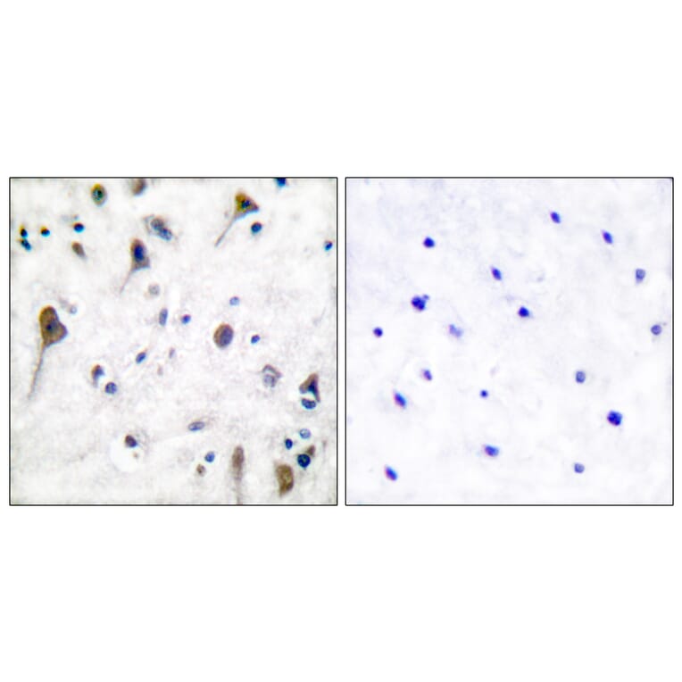 Immunohistochemistry - Anti-PYK2 (phospho Tyr580) Antibody (A0084) - Antibodies.com