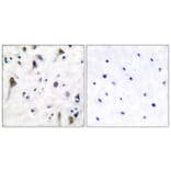 Immunohistochemistry - Anti-PYK2 (phospho Tyr580) Antibody (A0084) - Antibodies.com