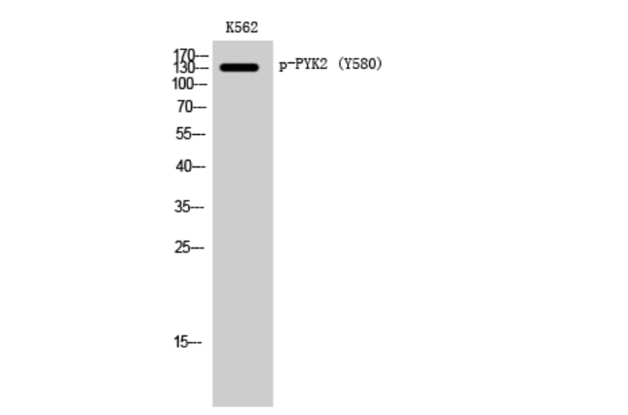 Western Blot - Anti-PYK2 (phospho Tyr580) Antibody (A0084) - Antibodies.com