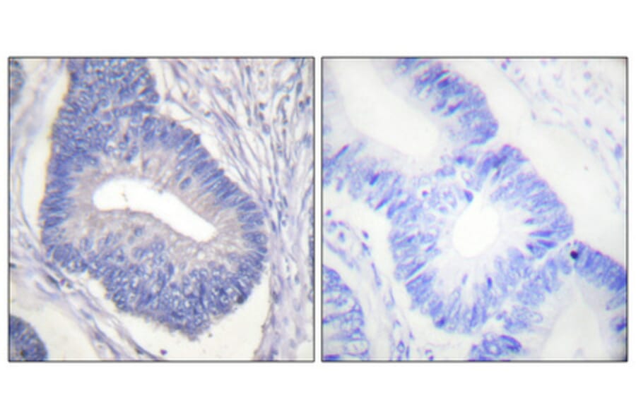 Immunohistochemistry - Anti-PYK2 (phospho Tyr580) Antibody (A0084) - Antibodies.com