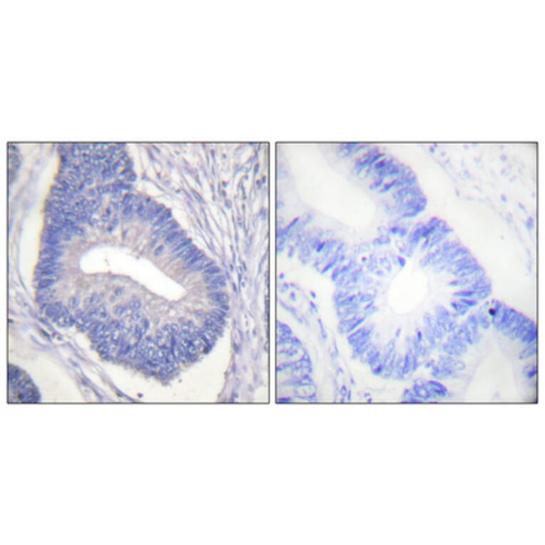 Immunohistochemistry - Anti-PYK2 (phospho Tyr580) Antibody (A0084) - Antibodies.com