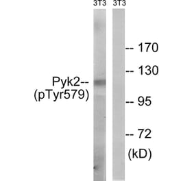 Western Blot - Anti-PYK2 (phospho Tyr579) Antibody (A8260) - Antibodies.com