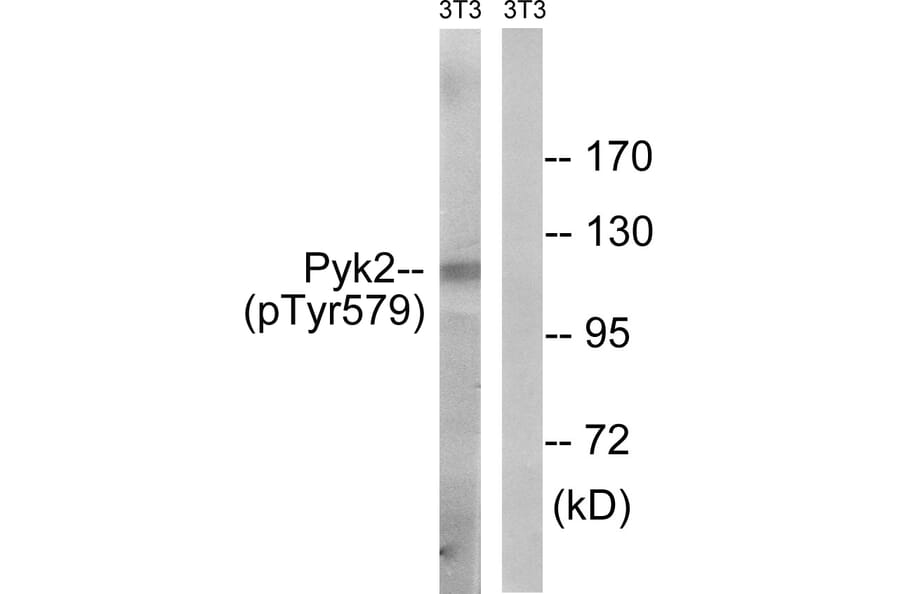 Western Blot - Anti-PYK2 (phospho Tyr579) Antibody (A8260) - Antibodies.com