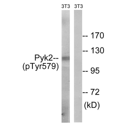 Western Blot - Anti-PYK2 (phospho Tyr579) Antibody (A8260) - Antibodies.com