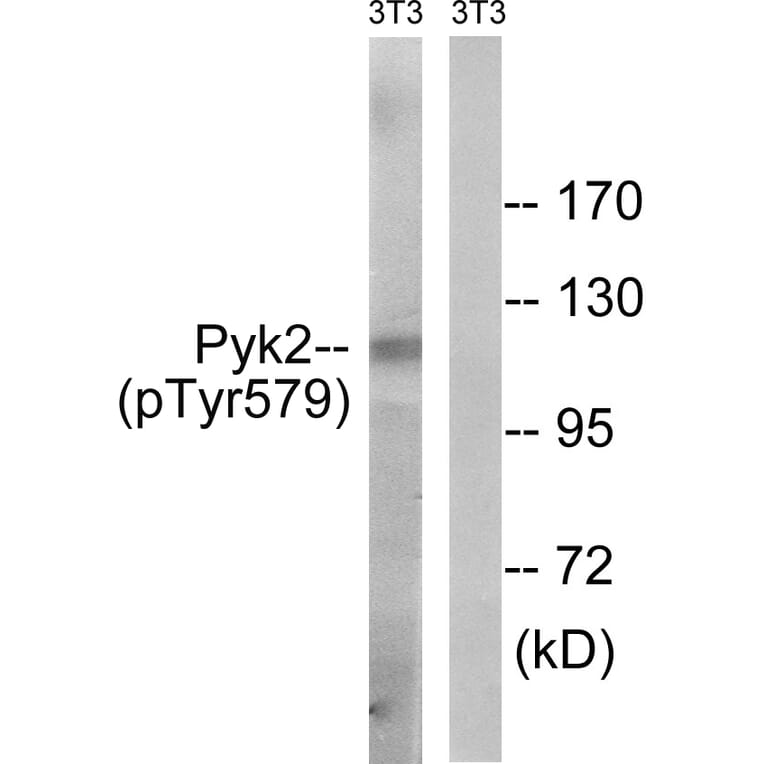 Western Blot - Anti-PYK2 (phospho Tyr579) Antibody (A8260) - Antibodies.com