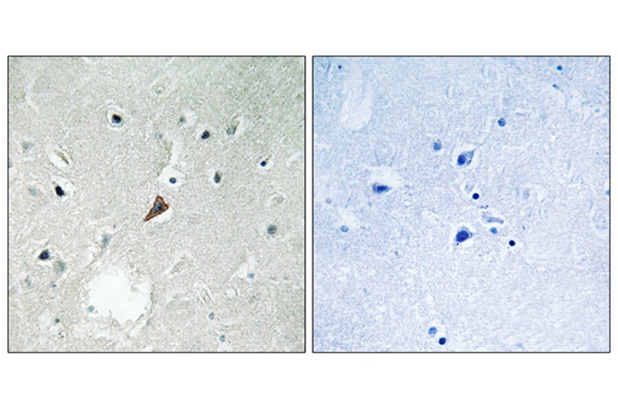 Immunohistochemistry - Anti-PYK2 (phospho Tyr579) Antibody (A8260) - Antibodies.com