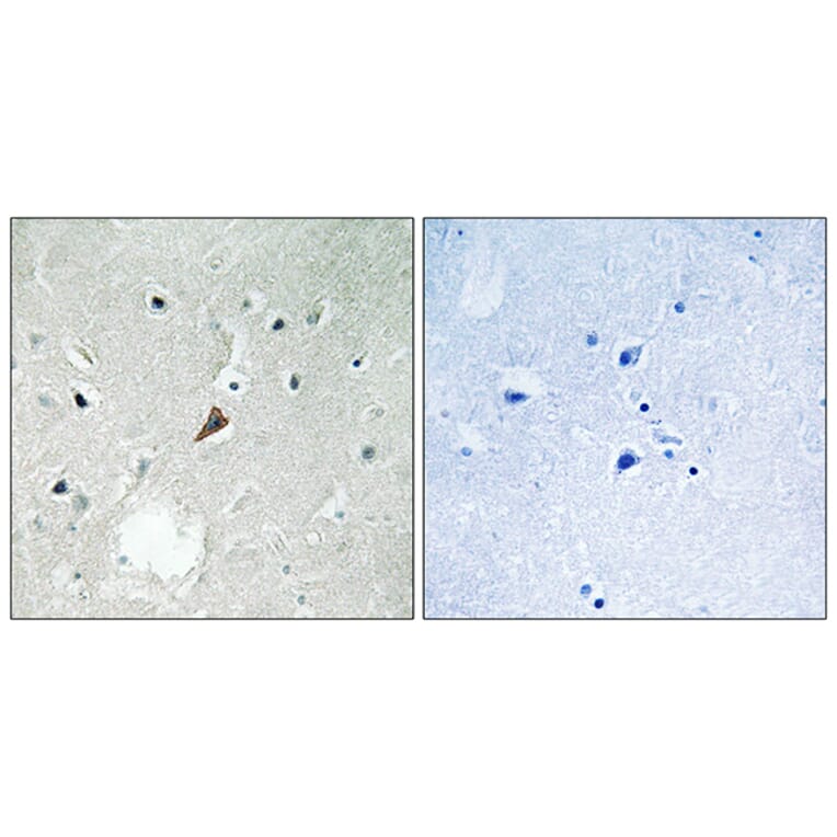 Immunohistochemistry - Anti-PYK2 (phospho Tyr579) Antibody (A8260) - Antibodies.com