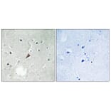 Immunohistochemistry - Anti-PYK2 (phospho Tyr579) Antibody (A8260) - Antibodies.com