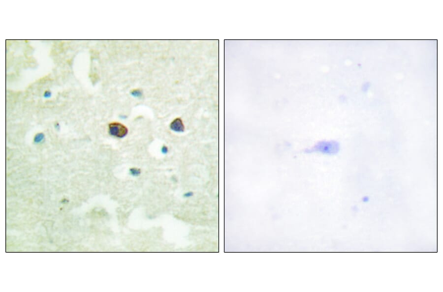 Immunohistochemistry - Anti-PTP1B (phospho Ser50) Antibody (A0809) - Antibodies.com
