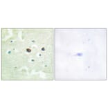 Immunohistochemistry - Anti-PTP1B (phospho Ser50) Antibody (A0809) - Antibodies.com