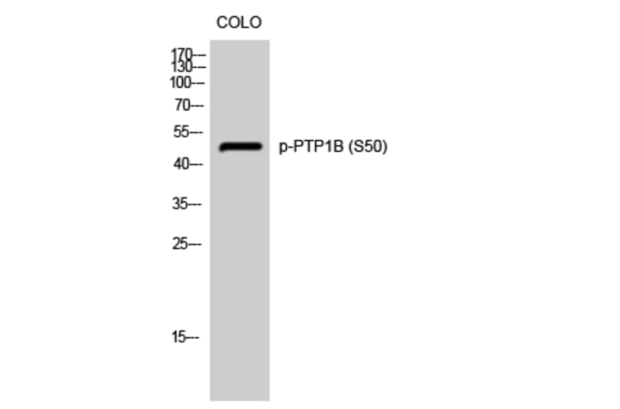 Western Blot - Anti-PTP1B (phospho Ser50) Antibody (A0809) - Antibodies.com