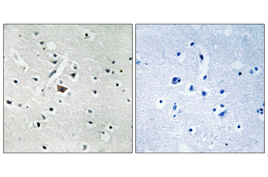 Immunohistochemistry - Anti-PLD2 (phospho Tyr169) Antibody (A8400) - Antibodies.com