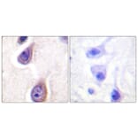 Immunohistochemistry - Anti-PLD1 (phospho Ser561) Antibody (A0723) - Antibodies.com