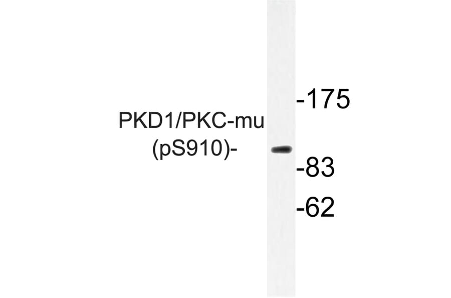 Western Blot - Anti-PKD1 (phospho Ser910) Antibody (P12-1045) - Antibodies.com