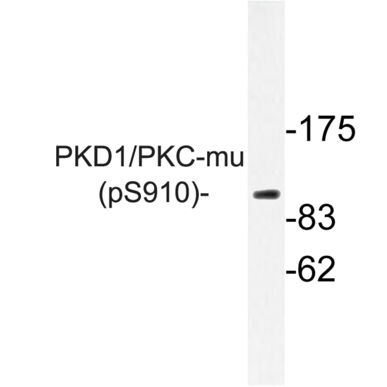 Western Blot - Anti-PKD1 (phospho Ser910) Antibody (P12-1045) - Antibodies.com