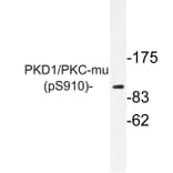 Western Blot - Anti-PKD1 (phospho Ser910) Antibody (P12-1045) - Antibodies.com