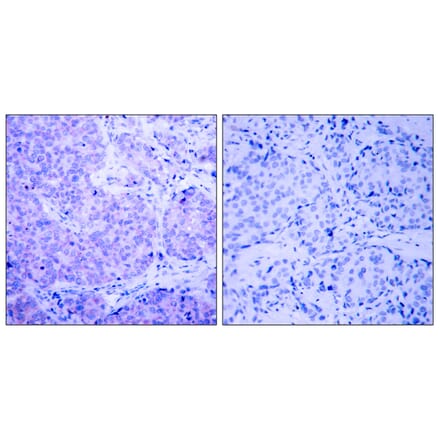 Immunohistochemistry - Anti-PDK1 (phospho Ser241) Antibody (A7195) - Antibodies.com