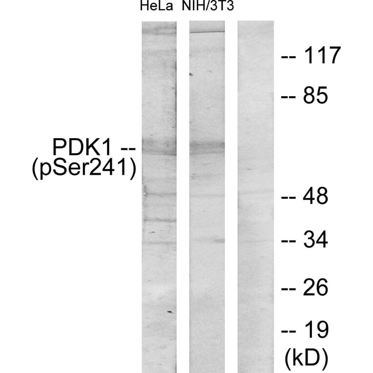 Western Blot - Anti-PDK1 (phospho Ser241) Antibody (A7195) - Antibodies.com