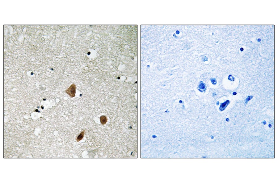 Immunohistochemistry - Anti-PAK3 (phospho Ser154) Antibody (A8163) - Antibodies.com