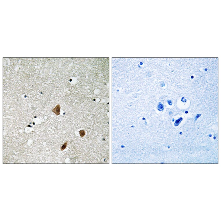 Immunohistochemistry - Anti-PAK3 (phospho Ser154) Antibody (A8163) - Antibodies.com