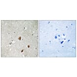 Immunohistochemistry - Anti-PAK3 (phospho Ser154) Antibody (A8163) - Antibodies.com