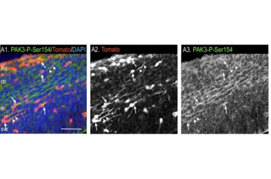 Immunostaining - Anti-PAK3 (phospho Ser154) Antibody - Antibodies.com