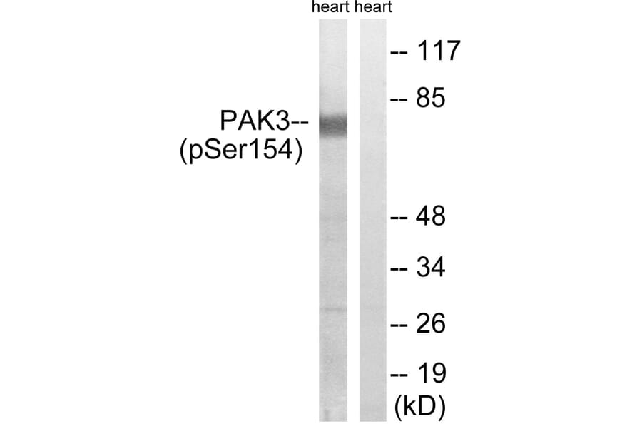Western Blot - Anti-PAK3 (phospho Ser154) Antibody (A8163) - Antibodies.com