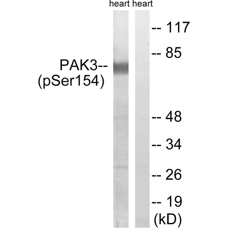 Western Blot - Anti-PAK3 (phospho Ser154) Antibody (A8163) - Antibodies.com