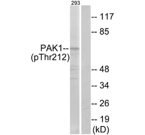 Western Blot - Anti-PAK1 (phospho Thr212) Antibody (A0539) - Antibodies.com