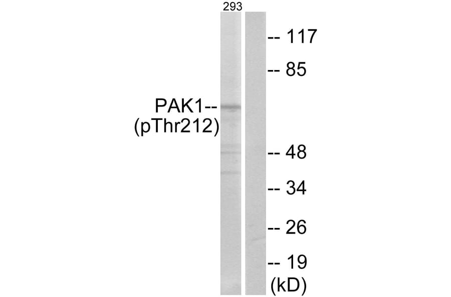 Western Blot - Anti-PAK1 (phospho Thr212) Antibody (A0539) - Antibodies.com