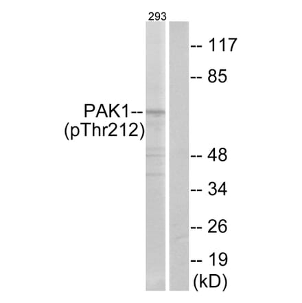 Western Blot - Anti-PAK1 (phospho Thr212) Antibody (A0539) - Antibodies.com